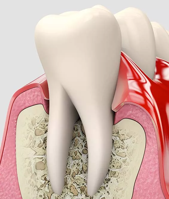 periodontics